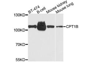 Western blot analysis of extracts of various cell lines, using CPT1B antibody. (CPT1B antibody  (AA 533-772))