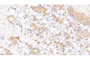 Detection of FASL in Human Stomach Tissue using Polyclonal Antibody to Factor Related Apoptosis Ligand (FASL) (FASL antibody  (AA 103-281))
