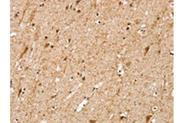 SRP68 antibody
