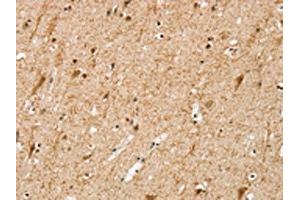 The image on the left is immunohistochemistry of paraffin-embedded Human brain tissue using ABIN7192648(SRP68 Antibody) at dilution 1/25, on the right is treated with synthetic peptide. (SRP68 antibody)