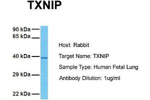 Host: Rabbit Target Name: TXNIP Sample Tissue: Human Fetal Lung Antibody Dilution: 1. (TXNIP antibody  (C-Term))