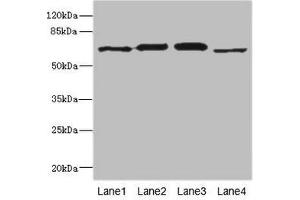 Western blot All lanes: RPN2 antibody at 1.