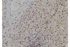 ABIN6278982 at 1/100 staining Human liver tissue by IHC-P.