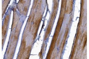 IHC analysis of PAK2 using anti-PAK2 antibody (ABIN7599219).