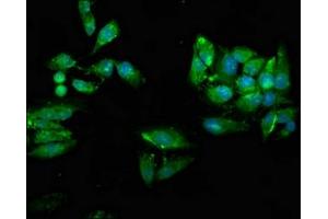 Immunofluorescence staining of Hela cells with ABIN7174472 at 1:66, counter-stained with DAPI. (UBE2N antibody  (AA 20-138))