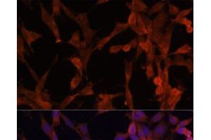 Immunofluorescence analysis of NIH-3T3 cells using UBE2G2 Polyclonal Antibody at dilution of 1:100. (UBE2G2 antibody)