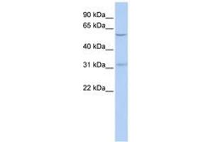 Image no. 1 for anti-Nucleus Accumbens Associated 1, BEN and BTB (POZ) Domain Containing (NACC1) (AA 252-301) antibody (ABIN6742506) (NAC1 antibody  (AA 252-301))