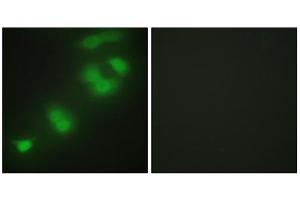 Immunofluorescence analysis of HepG2 cells, using CREBZF antibody. (CREBZF antibody  (C-Term))