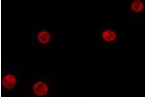 ABIN6275727 staining MCF7 by IF/ICC. (ZNF329 antibody  (N-Term))
