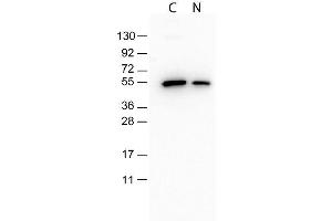 Monoclonal Antibody to detect conjugated proteins detects both C terminal linked and N terminal linked tagged recombinant proteins by western blot.