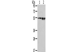 Western Blot analysis of TM4 cell and Human placenta tissue using EAAT3 Polyclonal Antibody at dilution of 1/500 (SLC1A1 antibody)