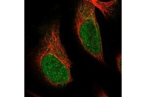 Immunofluorescent staining of human cell line U-2 OS with SRCAP polyclonal antibody  at 1-4 ug/mL dilution shows positivity in nucleus.