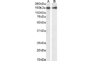 Western Blot using anti-CD56 antibody NCAM12. (Recombinant CD56 antibody)