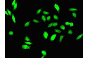 Immunofluorescent analysis of Hela cells using ABIN7155852 at dilution of 1:100 and Alexa Fluor 488-congugated AffiniPure Goat Anti-Rabbit IgG(H+L) (TGIF1 antibody  (AA 8-375))