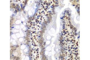 Immunohistochemistry of paraffin-embedded Rat intestine using PSMC3 Polyclonal Antibody at dilution of 1:200 (40x lens). (PSMC3 antibody)