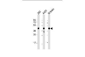 All lanes : Anti-PGK1 Antibody at 1:8000 dilution Lane 1: 293 whole cell lysate Lane 2: A431 whole cell lysate Lane 3: mouse brain lysate Lysates/proteins at 20 μg per lane. (PGK1 antibody  (AA 1-417))