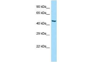 WB Suggested Anti-GMCL1 Antibody Titration: 1. (GMCL1 antibody  (C-Term))