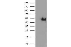 Image no. 2 for anti-LIM Homeobox 1 (LHX1) (AA 100-362) antibody (ABIN1490806) (LHX1 antibody  (AA 100-362))
