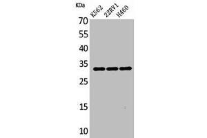 Western Blot analysis of K562 22RV-1 H460 cells using SCP-3 Polyclonal Antibody (SYCP3 antibody  (Internal Region))