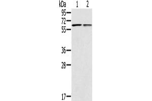 Western Blotting (WB) image for anti-Prostaglandin E Receptor 2 (Subtype EP2), 53kDa (PTGER2) antibody (ABIN2433631) (PTGER2 antibody)