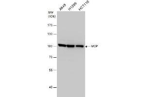 WB Image VCP antibody detects VCP protein by western blot analysis. (VCP antibody  (C-Term))