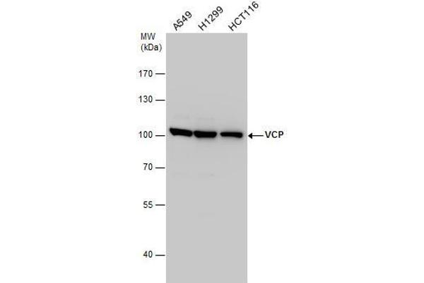 VCP anticorps  (C-Term)