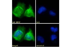 ABIN5539690 Immunofluorescence analysis of paraformaldehyde fixed U251 cells, permeabilized with 0. (BDNF antibody  (Internal Region))