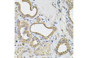Immunohistochemistry of paraffin-embedded human kidney using ICOSL Antibody (ABIN6130065, ABIN6142131, ABIN6142132 and ABIN6222879) at dilution of 1:100 (40x lens). (ICOSLG antibody  (AA 19-256))