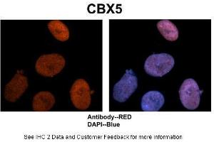 Sample Type :  Human NT-2 cells   Primary Antibody Dilution :  1:500  Secondary Antibody :  Goat anti-rabbit Alexa-Fluor 594  Secondary Antibody Dilution :  1:1000  Color/Signal Descriptions :  CBX5: Red DAPI:Blue  Gene Name :  CBX5  Submitted by :  Dr. (CBX5 antibody  (Middle Region))