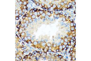 Immunohistochemistry of paraffin-embedded mouse testis using K/Elp3 Rabbit mAb (ABIN1680361, ABIN3015008, ABIN3015009 and ABIN7101302) at dilution of 1:100 (40x lens). (ELP3/KAT9 antibody)