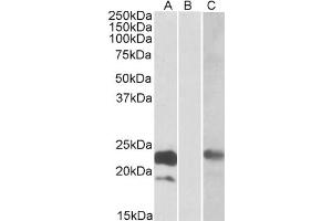 HEK293 lysate (10ug protein in RIPA buffer) overexpressing Human CST8 with C-terminal MYC tag probed with antibody (0. (CST8 antibody  (Internal Region))