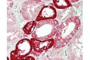 Human Kidney: Formalin-Fixed, Paraffin-Embedded (FFPE). (NADPH Oxidase 4 antibody  (AA 220-392) (Biotin))