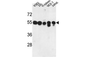 Western blot analysis of PPM1H Antibody in K562, 293, MCF-7, Jurkat cell line and mouse spleen tissue lysates (35ug/lane). (PPM1H antibody  (Middle Region))