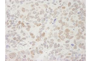 Immunohistochemistry (IHC) image for anti-Transcription Elongation Factor SPT5 (SUPT5H) (C-Term) antibody (ABIN7448819)