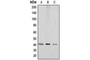Western blot analysis of GPR159 expression in HEK293T (A), mouse kidney (B), rat kidney (C) whole cell lysates. (CXCR7 antibody  (C-Term))