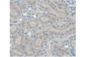 Detection of MCP1 in Mouse Kidney Tissue using Monoclonal Antibody to Monocyte Chemotactic Protein 1 (MCP1) (CCL2 antibody  (AA 24-96))