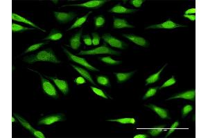 Immunofluorescence of purified MaxPab antibody to IGFBP3 on HeLa cell. (IGFBP3 antibody  (AA 1-291))