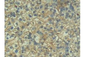 Immunohistochemistry (IHC) image for anti-P-Cadherin (CDH3) (AA 371-660) antibody (ABIN7437923)