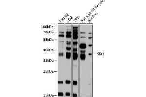Western blot analysis of extracts of various cell lines, using SIX1 antibody (ABIN6133368, ABIN6147805, ABIN6147806 and ABIN6215517) at 1:3000 dilution. (SIX Homeobox 1 antibody  (AA 60-270))
