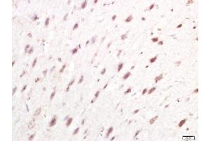 Paraformaldehyde-fixed, paraffin embedded rat brain tissue, Antigen retrieval by boiling in sodium citrate buffer(pH6) for 15min, Block endogenous peroxidase by 3% hydrogen peroxide for 30 minutes, Blocking buffer (normal goat serum) at 37°C for 20min, Antibody incubation with Rabbit Anti-IRF7 Polyclonal Antibody, Unconjugated  at 1:400 overnight at 4°C, followed by a conjugated secondary and DAB staining (IRF7 antibody  (AA 401-503))