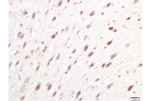 Paraformaldehyde-fixed, paraffin embedded rat brain tissue, Antigen retrieval by boiling in sodium citrate buffer(pH6) for 15min, Block endogenous peroxidase by 3% hydrogen peroxide for 30 minutes, Blocking buffer (normal goat serum) at 37°C for 20min, Antibody incubation with Rabbit Anti-IRF7 Polyclonal Antibody, Unconjugated  at 1:400 overnight at 4°C, followed by a conjugated secondary and DAB staining