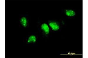 Immunofluorescence of monoclonal antibody to PIM1 on HeLa cell. (PIM1 antibody  (AA 1-100))