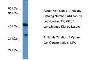 WB Suggested Anti-Centa1  Antibody Titration: 0. (ADAP1 antibody  (C-Term))