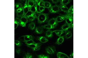 Immunofluorescence Analysis of HeLa cells labeling with Beta-2-Microglobulin Mouse Recombinant Monoclonal Antibody (rB2M/961) followed by Goat anti-mouse IgG-CF488 (Green).