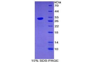 SDS-PAGE (SDS) image for Early Growth Response 4 (EGR4) (AA 231-474) protein (His tag) (ABIN2124688) (EGR4 Protein (AA 231-474) (His tag))