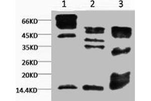 Western blot analysis of 1) Hela, 2) Rat Testis tissue, 3) Raw264. (Tri-Methyl-Histone H3(K9) (H3K9me3) antibody)