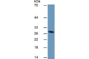 Mouse Detection antibody from the kit in WB with Positive Control:  Sample Human liver Tissue. (IGFBP4 ELISA Kit)