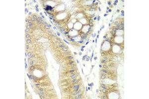 Immunohistochemistry of paraffin-embedded human colon using CES2 antibody (ABIN5970708) at dilution of 1/100 (40x lens). (CES2 antibody)
