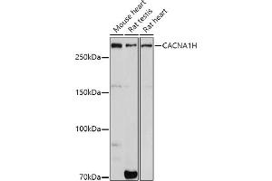 Western blot analysis of extracts of various cell lines, using CH antibody (ABIN7266015) at 1:1000 dilution. (CACNA1H antibody  (AA 260-360))