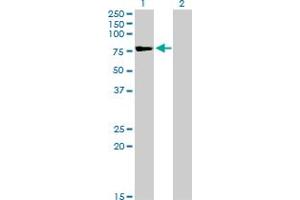 Western Blot analysis of TSGA10 expression in transfected 293T cell line by TSGA10 monoclonal antibody (M08), clone 6E8.